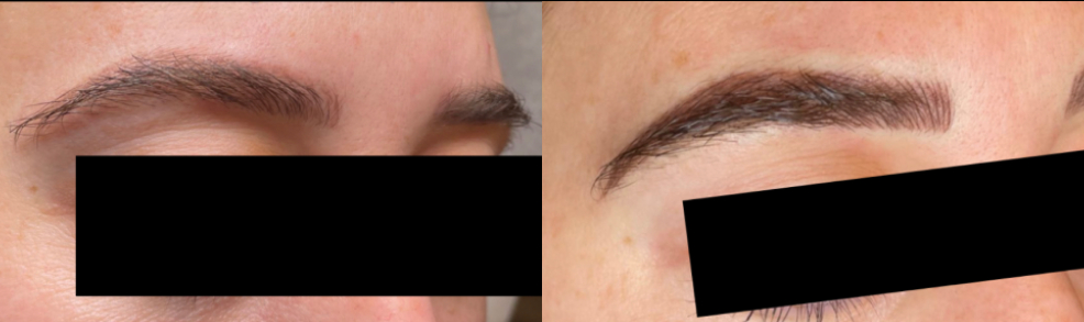microblading before after