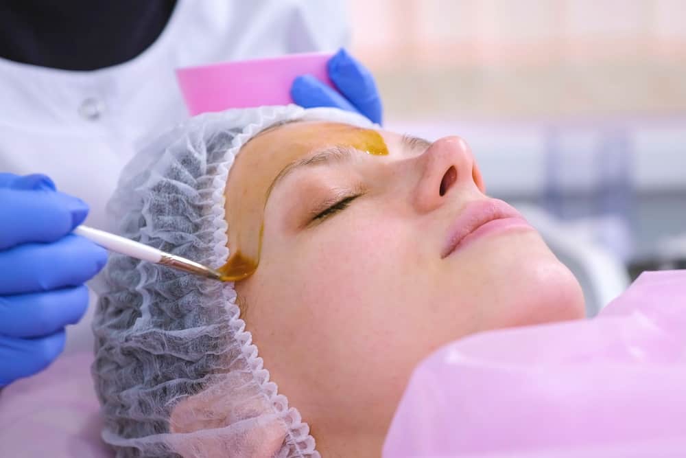 The Ultimate Guide To Chemical Peels For Skin Rejuvenation What You Need To Know