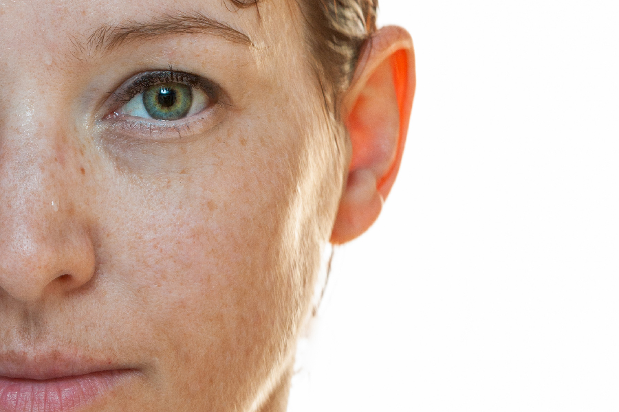 Naturally strong portrait half sided of a woman without make up with sun spots on her face