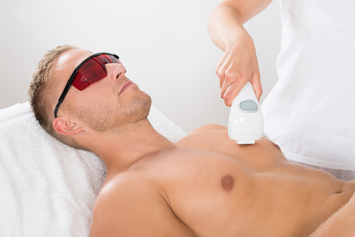 mens laser hair removal2