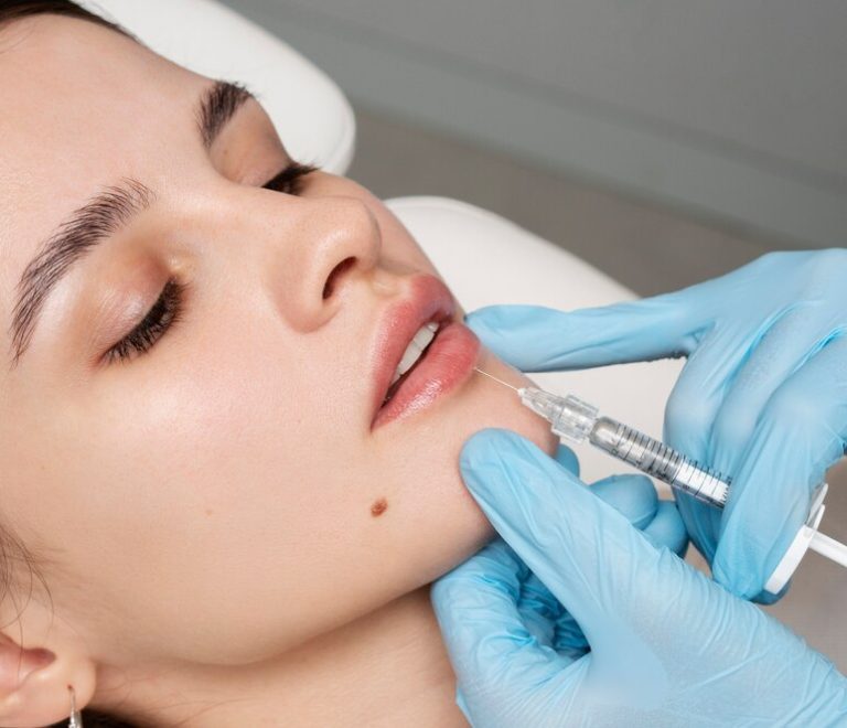 Top Benefits of Dermal Fillers for Anti-Aging